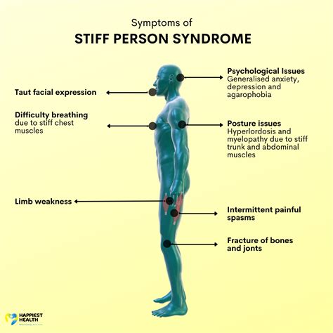 prognosis of stiff person syndrome.